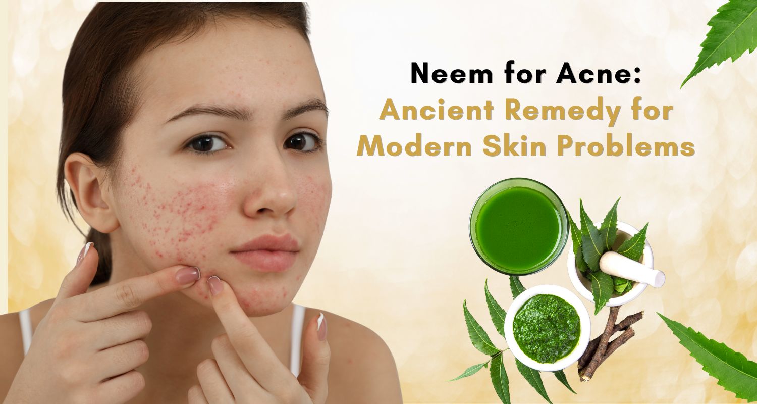 Neem for Acne: Ancient Remedy for Modern Skin Problems